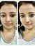 Bindu N...