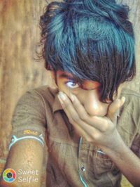 'වයිල්ඩ්' ස්කේයිට්෴