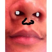 Perperperperperperper Perperperperper