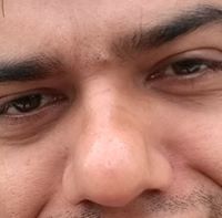 Lokesh