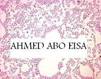 Ahmed Abo Eisa