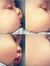 Nody Ha...
