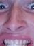 Brady L...