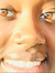 Perrishea