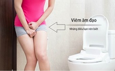 Chữa viêm âm đạo