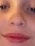 Xen