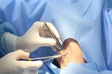 Thẩm mỹ viện Uy tín