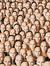 Prosopagnosia-sia