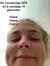 Loes