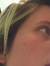 heather