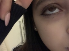 iris 