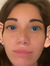Seren B...