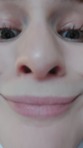 elendusfendus