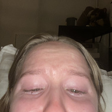 Frida Ånmark