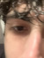 erdal