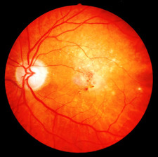 Line Cecilie Eskerod