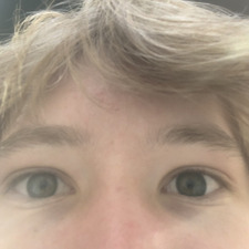 Kye