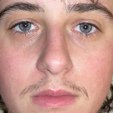 Braeden Baston