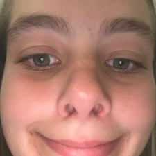 Anissa Houssa