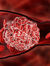 thrombus