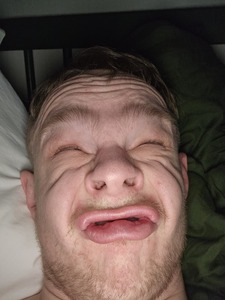 Axel Fors