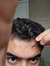 Al