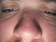 Nicholas