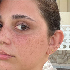 ane&#x1faf6;&#x1f3fb;