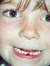 Peiffer...