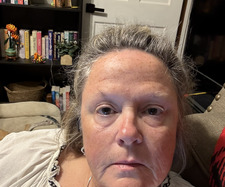 Lynn Lewis