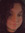 Katy Lally