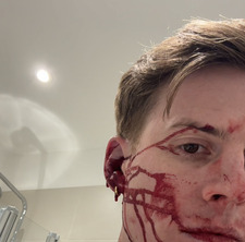 Harry Butchart