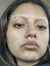 ashlyn