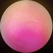 Klod