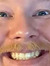 Mikkel