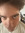 John forehead