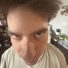 John forehead