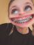 Breanna...