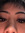 Analyse Abela