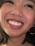 rach