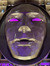 emr