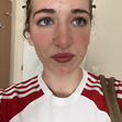 noa
