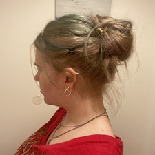 scar :)