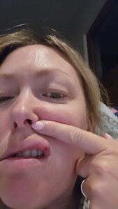 Gemma